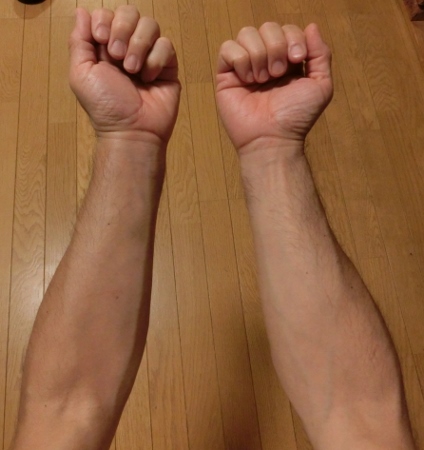 俺の左腕が…